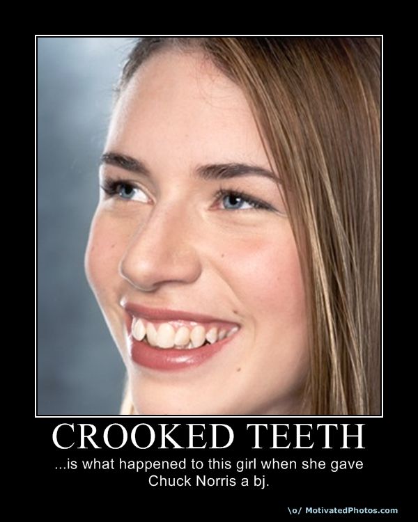 Crooked teeth. 